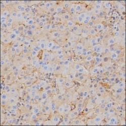 Invitrogen Human Serum Albumin Monoclonal Antibody (KT11) 100 &mu;L | Buy Online | Invitrogen&trade; | Fisher Scientific