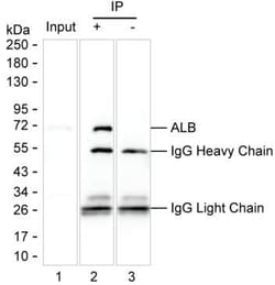 Invitrogen Human Serum Albumin Monoclonal Antibody (KT11) 100 &mu;L | Buy Online | Invitrogen&trade; | Fisher Scientific