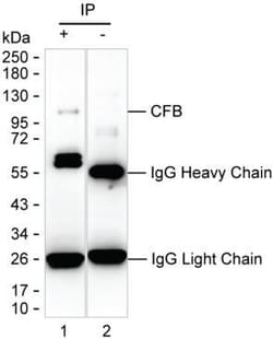 Invitrogen Complement Factor B Monoclonal Antibody (KT21) 100 &mu;g; Unconjugated:Antibodies,