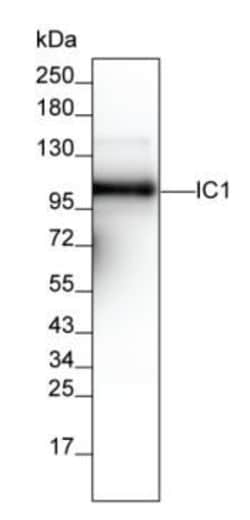 Invitrogen C1 inhibitor Monoclonal Antibody (KT28) 100 &mu;L; Unconjugated:Antibodies,