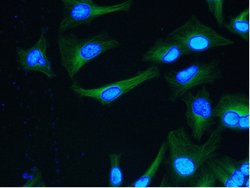 Invitrogen alpha Tubulin Monoclonal Antibody (YOL1/34) 500 &mu;g; Unconjugated:Antibodies,