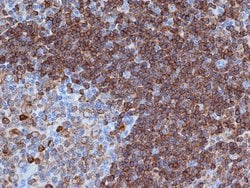 Invitrogen CD79a Monoclonal Antibody (HM57) 200 &mu;g; Unconjugated:Antibodies,