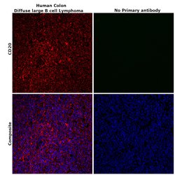 Invitrogen CD20 Monoclonal Antibody (2H7) 200 &mu;g; Unconjugated:Antibodies,