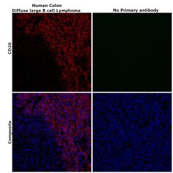 Invitrogen CD20 Monoclonal Antibody (2H7) 200 &mu;g; Unconjugated:Antibodies,