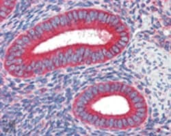 Invitrogen Calreticulin Monoclonal Antibody (FMC 75) 100 &mu;g | Buy Online | Invitrogen&trade; | Fisher Scientific