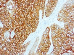 Invitrogen Cytokeratin 5/6 Monoclonal Antibody (D5/16 B4) 250 &mu;L; Unconjugated:Antibodies,