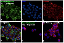 Invitrogen Cytokeratin Pan Monoclonal Antibody (B311.1) 500 &mu;L; Unconjugated:Antibodies,