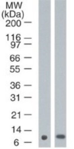 Invitrogen S100A7 Monoclonal Antibody (47C1068) 100 &mu;g; Unconjugated:Antibodies,