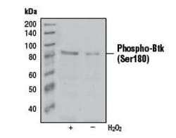 Invitrogen Phospho-Btk (Ser180) Monoclonal Antibody (3i5 (3D3)) 50 &mu;L | Buy Online | Invitrogen&trade; | Fisher Scientific
