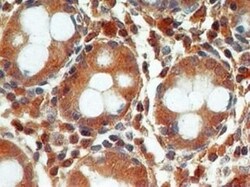 Active/Pro-Caspase 3 Monoclonal Antibody (31A1067), Invitrogen 100 &mu;g;