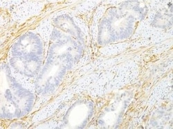 Invitrogen TEM8 Monoclonal Antibody (200C1339) 100 &mu;g; Unconjugated:Antibodies,