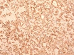 Invitrogen TEM8 Monoclonal Antibody (200C1339) 100 &mu;g; Unconjugated:Antibodies,