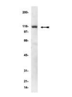 Invitrogen alpha Actinin 1 Monoclonal Antibody (0.T.02) 100 &mu;g | Buy Online | Invitrogen&trade; | Fisher Scientific