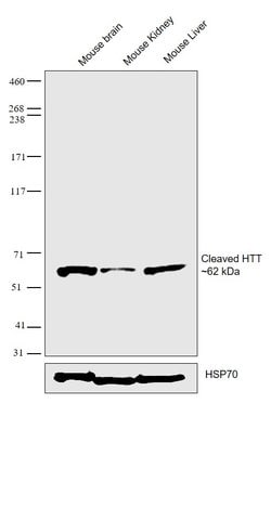 Invitrogen Huntingtin Monoclonal Antibody (4-13) 100 &mu;g; Unconjugated:Antibodies,