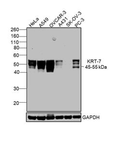 Invitrogen Cytokeratin 7 Monoclonal Antibody (OVTL12/30) 100 &mu;L; Unconjugated:Antibodies,
