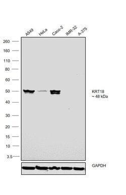 Invitrogen Cytokeratin 18 Monoclonal Antibody (RGE53) 100 &mu;L; Unconjugated:Antibodies,