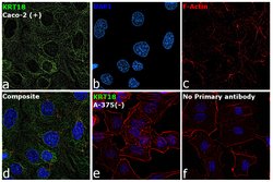 Invitrogen Cytokeratin 18 Monoclonal Antibody (RCK106) 100 &mu;g; Unconjugated:Antibodies,