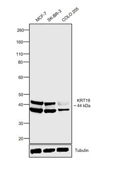 Invitrogen Cytokeratin 19 Monoclonal Antibody (RCK108) 100 &mu;L; Unconjugated:Antibodies,