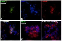 Invitrogen CD20 Monoclonal Antibody (2H7) 100 &mu;g; Unconjugated:Antibodies,