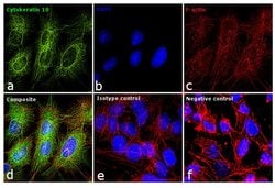 Invitrogen Cytokeratin 18 Monoclonal Antibody (C-04), FITC 100 &mu;g; FITC:Antibodies,