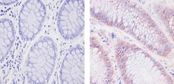 Invitrogen SOD1 Monoclonal Antibody (8B10) 100 &mu;g; Unconjugated:Antibodies,