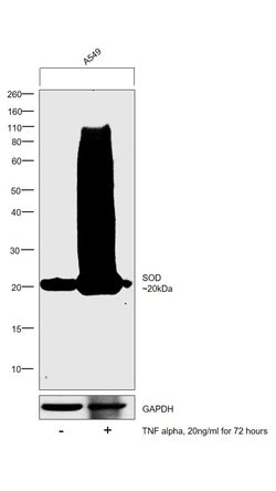 Invitrogen SOD2 Monoclonal Antibody (1H6) 100 &mu;g; Unconjugated:Antibodies,