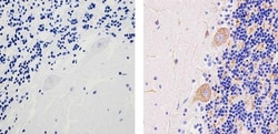 Invitrogen SOD2 Monoclonal Antibody (1H6) 100 &mu;g; Unconjugated:Antibodies,