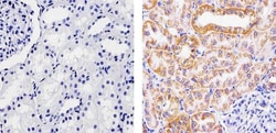 Invitrogen SOD2 Monoclonal Antibody (1H6) 100 &mu;g; Unconjugated:Antibodies,