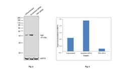 Invitrogen TBP Monoclonal Antibody (1TBP18) 200 &mu;g; Unconjugated:Antibodies,