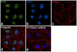 Invitrogen PAX8 Monoclonal Antibody (1F8-3A8) 100 &mu;g; Unconjugated:Antibodies,