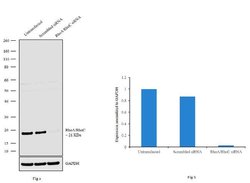 Invitrogen RhoA/RhoC Monoclonal Antibody (1B3-4A10) 100 &mu;g; Unconjugated:Antibodies,