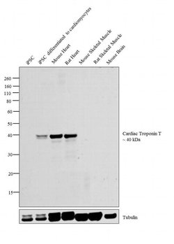 Invitrogen Cardiac Troponin T Monoclonal Antibody (1C11cc) 200 &mu;g; Unconjugated:Antibodies,