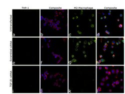 Invitrogen&trade;&nbsp;TGF beta-1 Monoclonal Antibody (B11-4C3)
