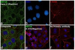 Invitrogen Cytokeratin 18 Monoclonal Antibody (DA-7) 100 &mu;g; Unconjugated:Antibodies,