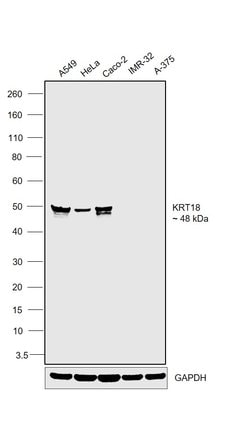 Invitrogen Cytokeratin 18 Monoclonal Antibody (DA-7) 100 &mu;g; Unconjugated:Antibodies,