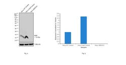 beta-2 Microglobulin Monoclonal Antibody (B2M-01), Invitrogen 100 &mu;g;