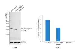 beta-2 Microglobulin Monoclonal Antibody (B2M-01), Invitrogen 100 &mu;g;