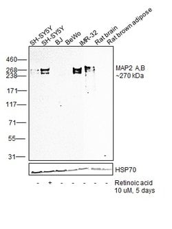 Invitrogen MAP2 Monoclonal Antibody (MT-01) 100 &mu;g; Unconjugated:Antibodies,