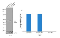 Invitrogen LCK Monoclonal Antibody (LCK-01) 100 &mu;g; Unconjugated:Antibodies,