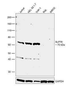 Invitrogen SLP76 Monoclonal Antibody (SLP-76/03) 100 &mu;g; Unconjugated:Antibodies,