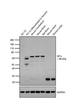 Invitrogen NEFL Monoclonal Antibody (DA2) 100 &mu;g; Unconjugated:Antibodies,