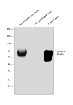 Invitrogen Transferrin Monoclonal Antibody (12A6) 100 &mu;g; Unconjugated:Antibodies,