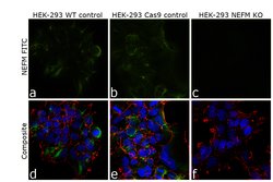Invitrogen NEFM Monoclonal Antibody (3H11) 100 μg; Unconjugated:Antibodies,