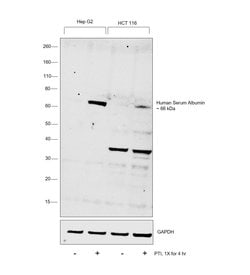 Invitrogen Human Serum Albumin Monoclonal Antibody (6B11) 100 &mu;g; Unconjugated:Antibodies,