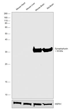 Invitrogen Synaptophysin Monoclonal Antibody (SY38) 100 &mu;g | Buy Online | Invitrogen&trade; | Fisher Scientific