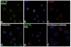 Invitrogen Zap-70 Monoclonal Antibody (1E7.2) 100 &mu;g; Unconjugated:Antibodies,