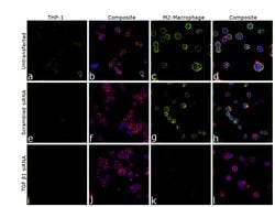 Invitrogen&trade;&nbsp;TGF beta-1 Monoclonal Antibody (TB21)