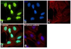Ku70/Ku80 Monoclonal Antibody (162), Invitrogen 500 &mu;L; Unconjugated:Antibodies,