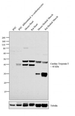 Invitrogen Cardiac Troponin T Monoclonal Antibody (7G7) 200 &mu;g; Unconjugated:Antibodies,
