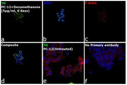 Invitrogen&trade;&nbsp;Tyrosine Hydroxylase Monoclonal Antibody (185)